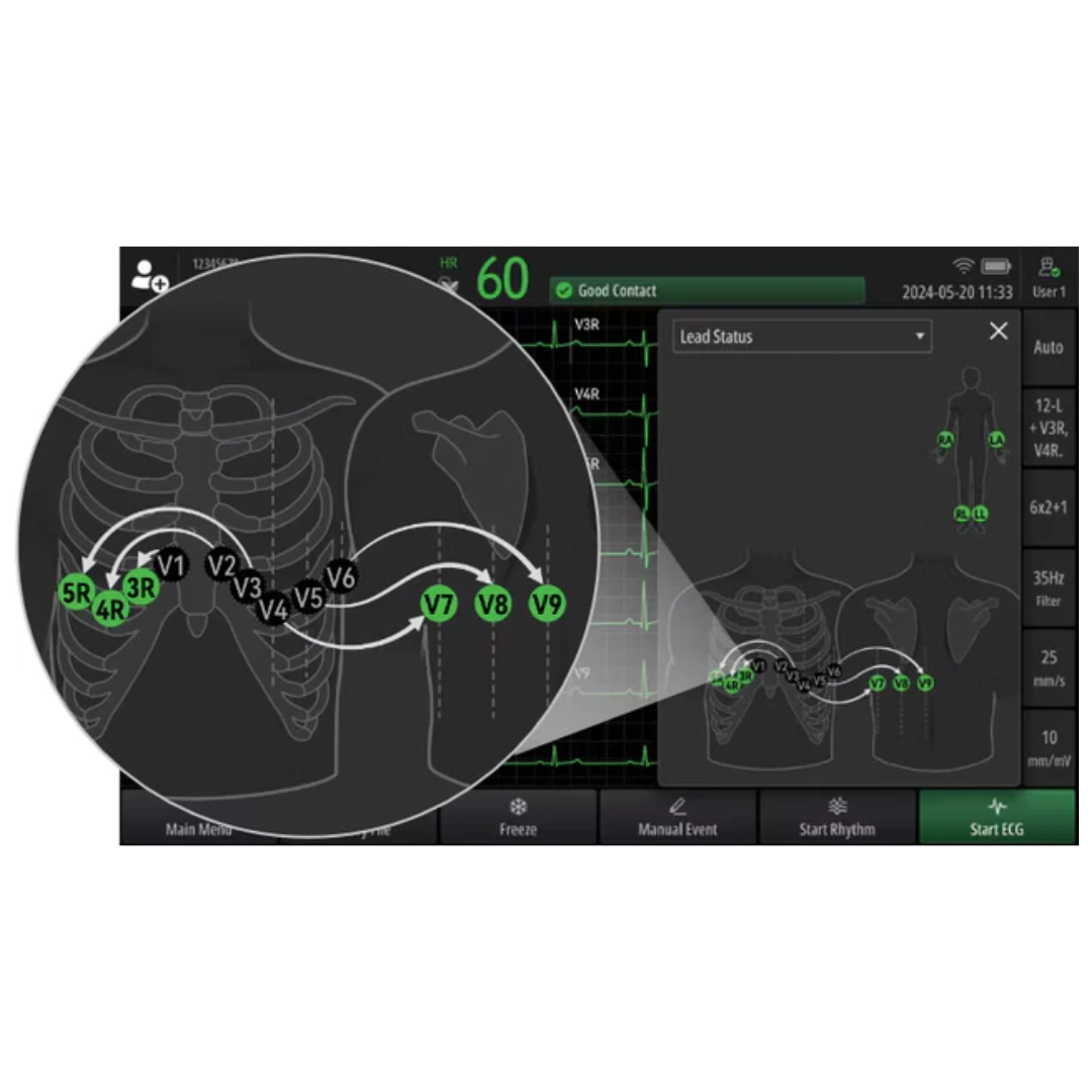 BeneHeart R700 Mindray : ECG professionnel 12 dérivations