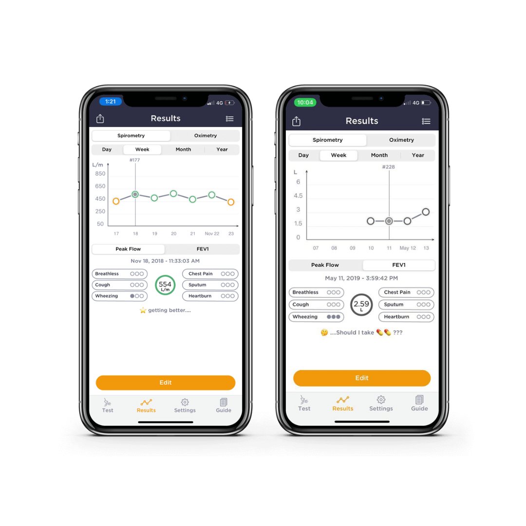 Spiromètre Smart One Oxi - MIR