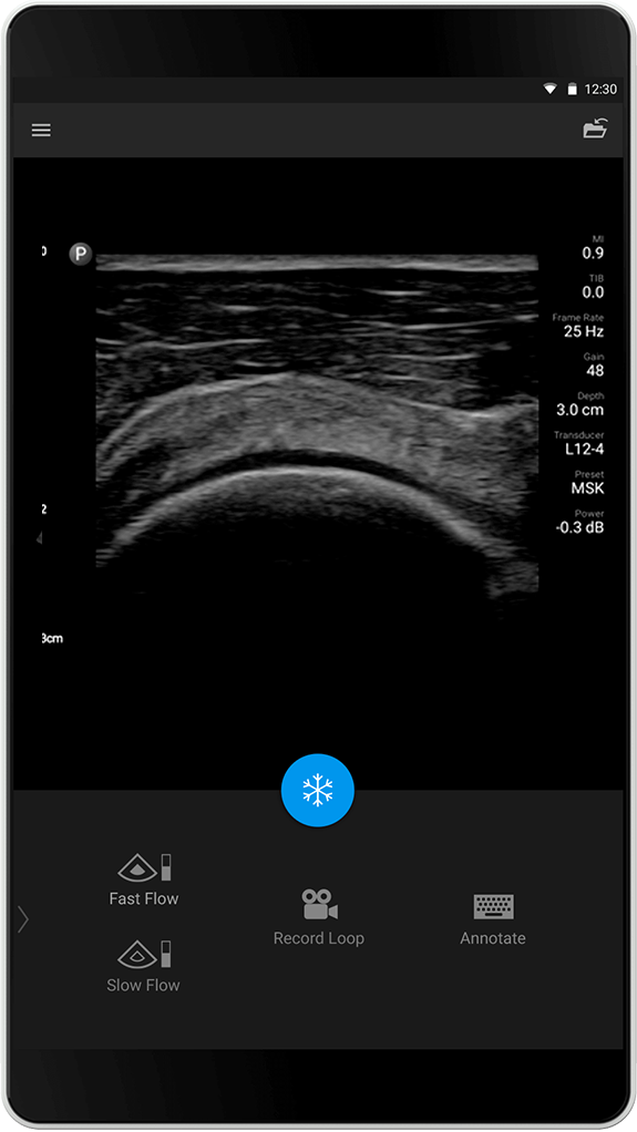 Philips Lumify échographe portable connecté