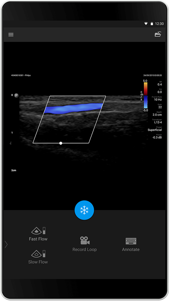 Philips Lumify échographe portable connecté