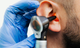 Otoscopes