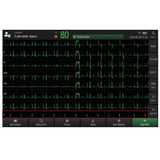 BeneHeart R700 Mindray : ECG professionnel 12 dérivations