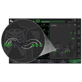 BeneHeart R700 Mindray : ECG professionnel 12 dérivations