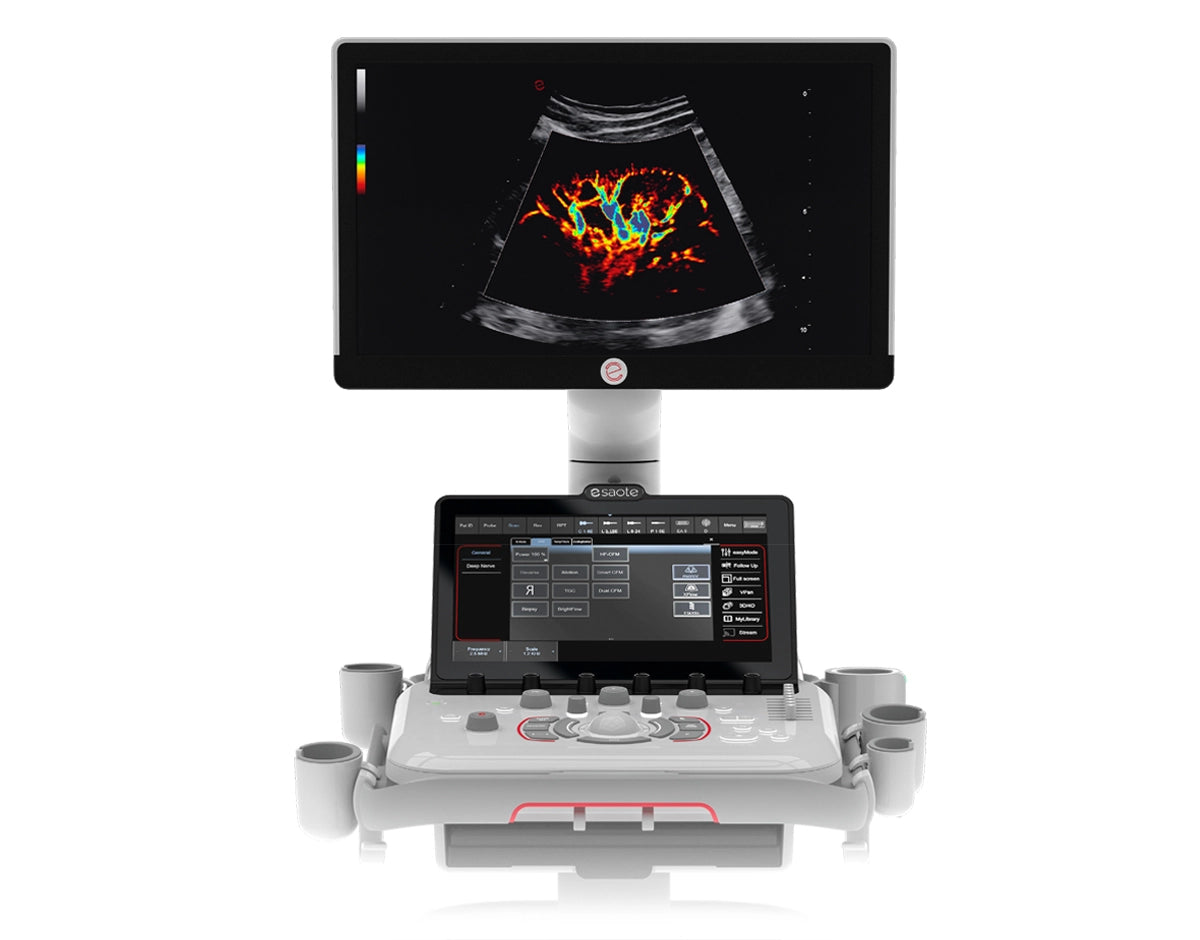 échographe MyLab A50 ESAOTE
