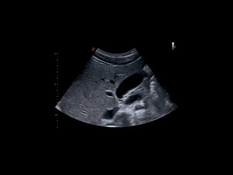 Echographie MyLab™X1 Esaote