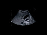 Echographie MyLab™X1 Esaote