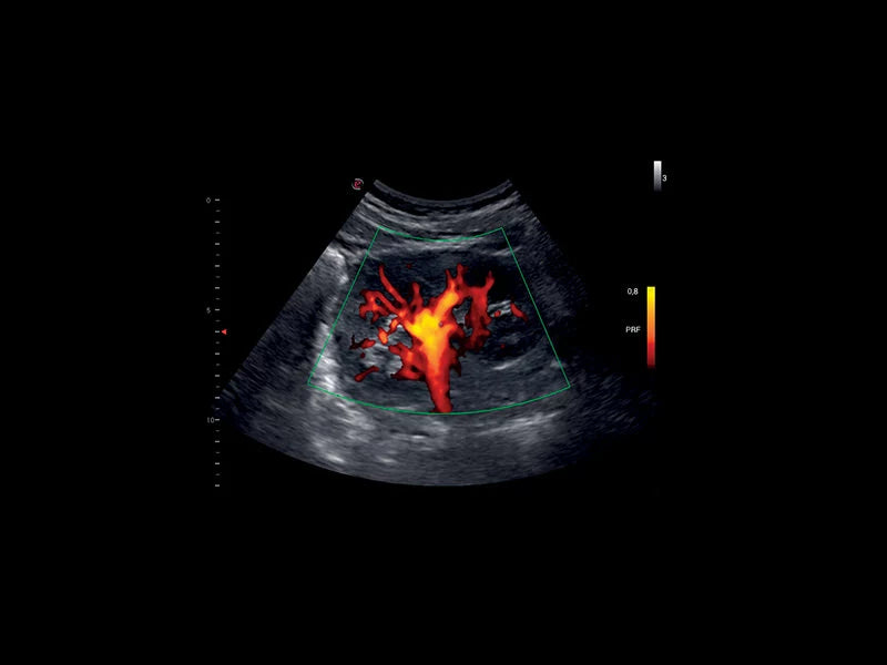 Echographie MyLab™X1 Esaote
