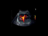 Echographie MyLab™X1 Esaote