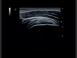 échographe Mylab ESAOTE
