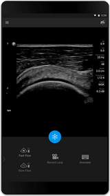 Philips Lumify échographe portable connecté