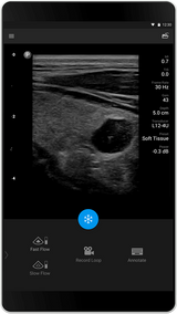 Philips Lumify échographe portable connecté
